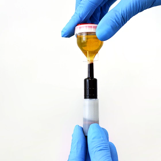 Обогащенная плазма крови, Platelet Rich Plasma (PRP) Доктор Ост